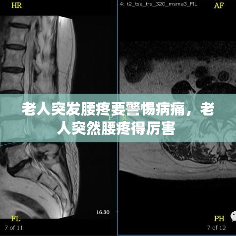 老人突发腰疼要警惕病痛，老人突然腰疼得厉害 