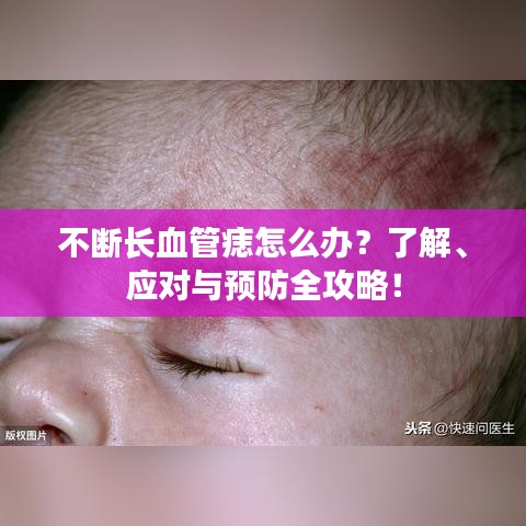 不断长血管痣怎么办?了解、应对与预防全攻略!