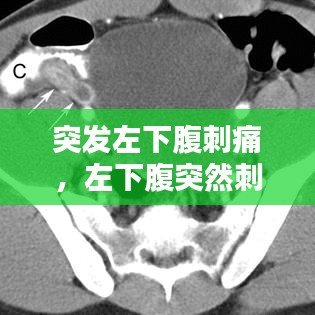 突发左下腹刺痛,左下腹突然刺痛的原因