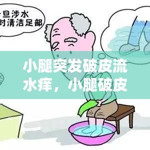 小腿突发破皮流水痒,小腿破皮瘙痒