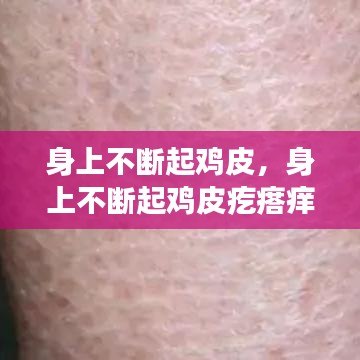 身上不断起鸡皮,身上不断起鸡皮疙瘩痒