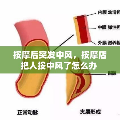 按摩后突发中风,按摩店把人按中风了怎么办