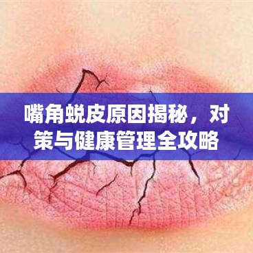 嘴角蜕皮原因揭秘，对策与健康管理全攻略