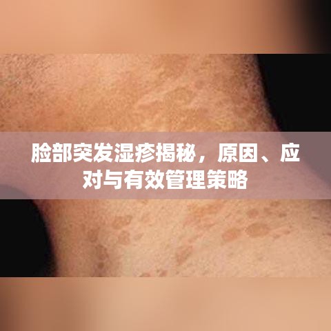脸部突发湿疹揭秘，原因、应对与有效管理策略