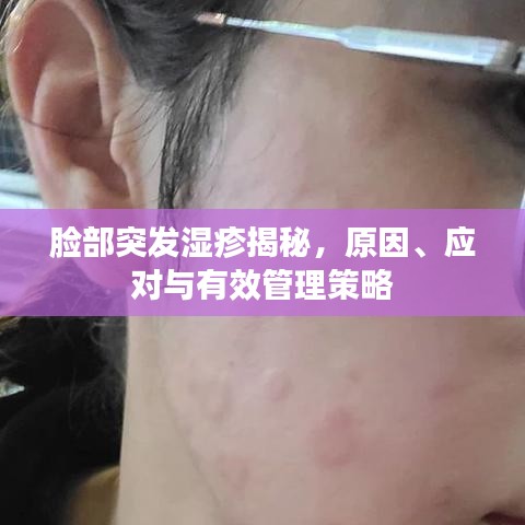 脸部突发湿疹揭秘,原因、应对与有效管理策略