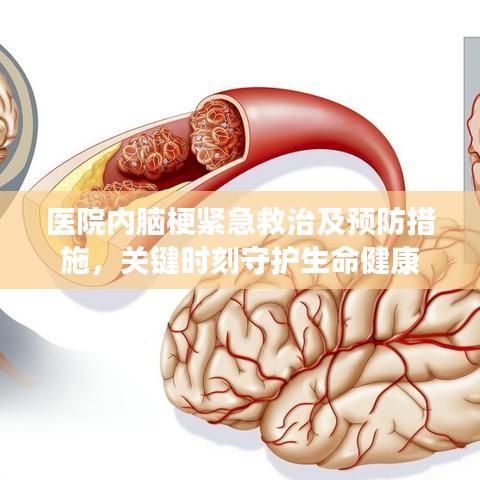 医院内脑梗紧急救治及预防措施，关键时刻守护生命健康