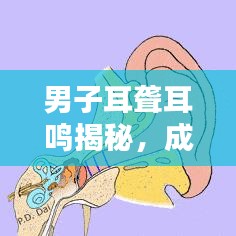 男子耳聋耳鸣揭秘,成因、应对方法与预防措施
