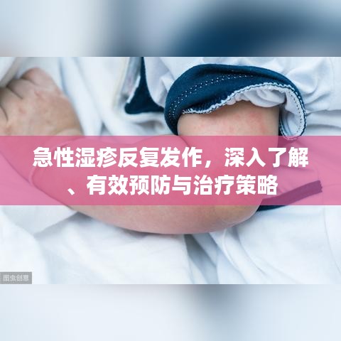 急性湿疹反复发作，深入了解、有效预防与治疗策略