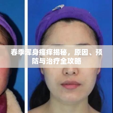 春季浑身瘙痒揭秘,原因、预防与治疗全攻略